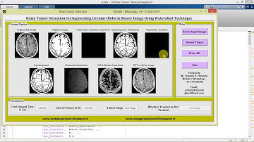 Brain Tumor Detection Using Watershed Technique Matlab Project with Source Code