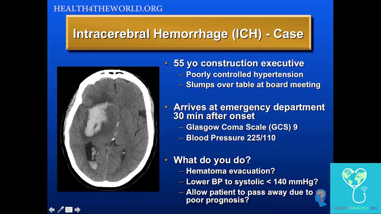 Intracerebral Hemorrhage   Case Study | Health4TheWorld Academy