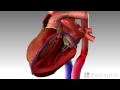 3D Medical Animation - Congestive Heart Failure