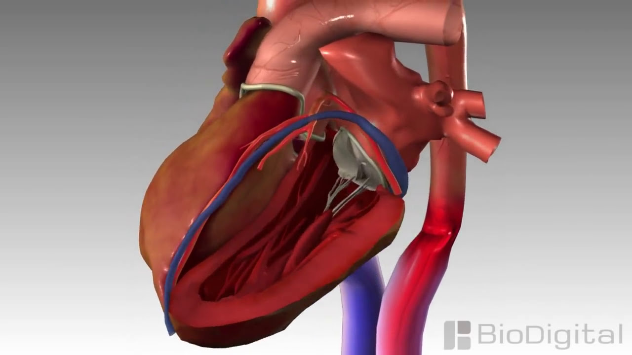 3D Medical Animation - Congestive Heart Failure - YouTube