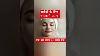झाईयों को permanent treatment #shorts #shortvideo #youtubeshorts #skincareroutine #jhaiyonkailaj