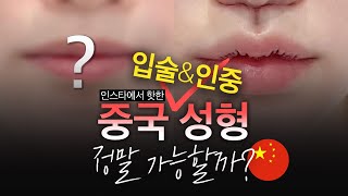 [SNS에서 핫한 중국 성형] 오목인중 &amp; 입술성형 가능할까?