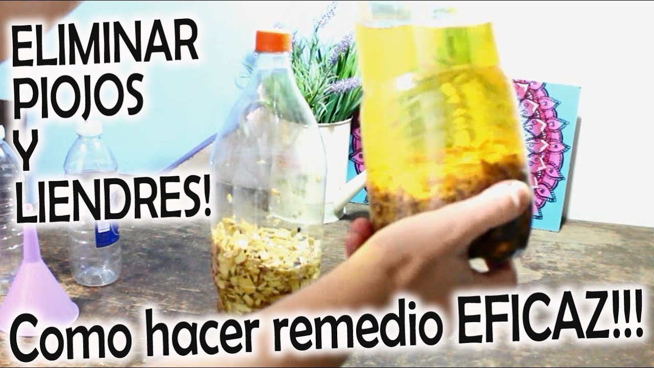 matar piojos con alcohol