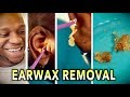ENDLESS EARWAX REMOVAL! | Dr. Paul (feat. Themba "my son")