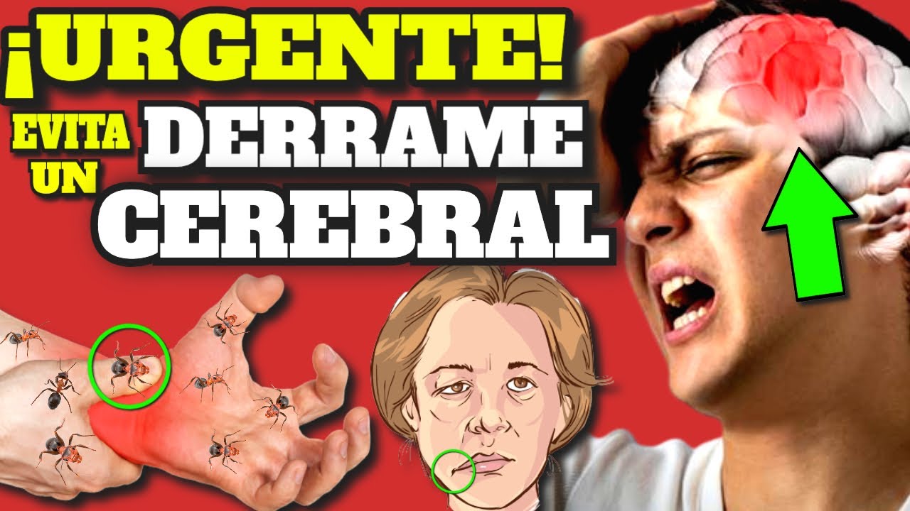 ¡PELIGRO! SÍNTOMAS de ALARMA de DERRAME CEREBRAL| ACV TRATAMIENTO y COMO EVITAR