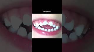 Kit Criança Encapetada Menina - Gugu Amaral