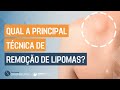 Qual a principal TÉCNICA de remoção de LIPOMAS?