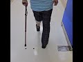 종아리의지 하퇴 의족 실리콘형 보행