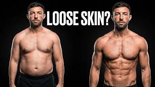 The Truth About Loose Skin When Getting Lean