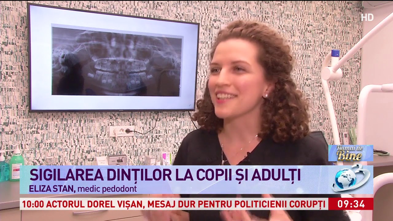 Sigilarea dinţilor, o barieră împotriva cariilor