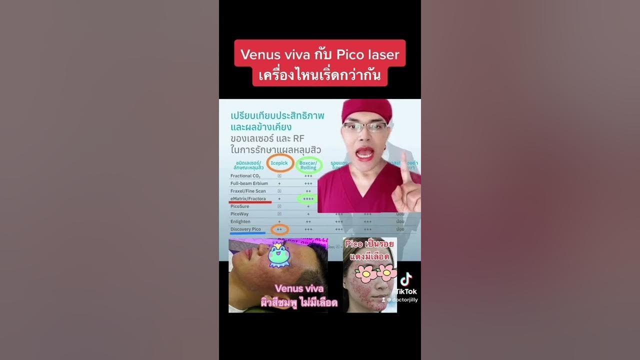 รักษาหลุมสิว Venus viva หรือ Pico laser ดีกว่ากัน YouTube