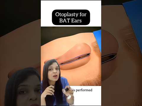 Surgery for Bar