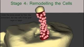 The Healing Process of the ACL Graft