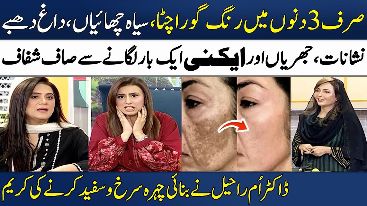 Dr. Umme Raheel Made a Skin Whitening Cream🌟 | Chehre Ki Chaiyon Aur Acne ka Ilaaj💯 | Madeha Naqvi
