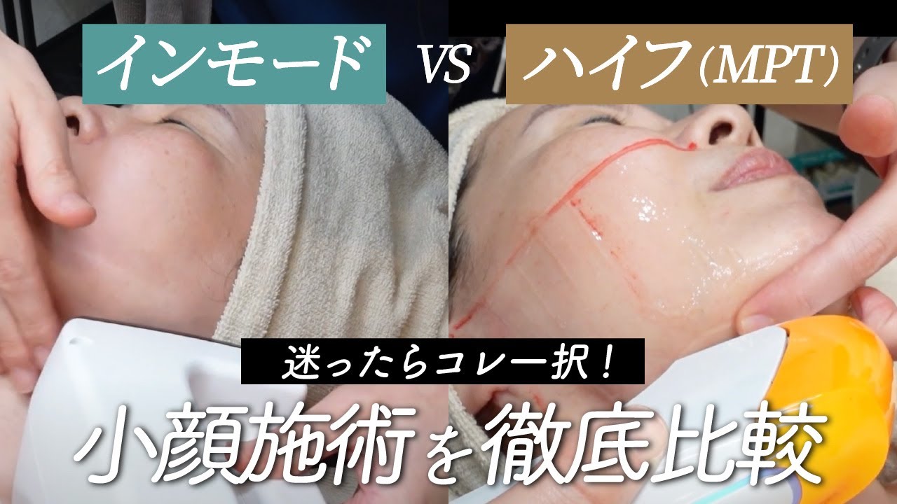 【インモードVSハイフ】 肌のたるみ引き締めにはどっちが良い？ 院長が半顔ずつで検証してみた！