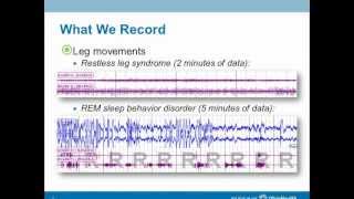 How is restless leg syndrome detected during a sleep study?