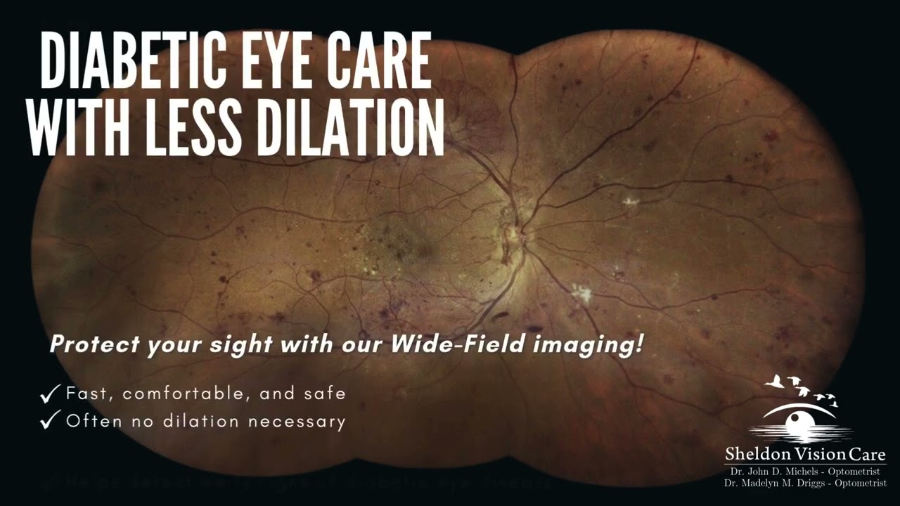 Diabetic Eye Care With Less Dilation