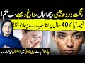 Milk-Like Fair Skin | Remove Dark Spots Wrinkles &amp; Blemishes Naturally | Naima Appa | GT Digital1