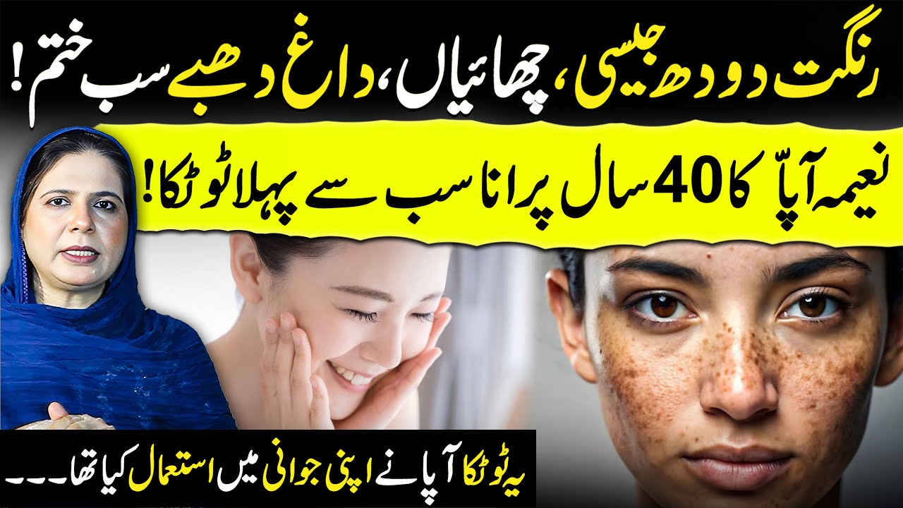 Milk-Like Fair Skin | Remove Dark Spots Wrinkles & Blemishes Naturally | Naima Appa | GT Digital1
