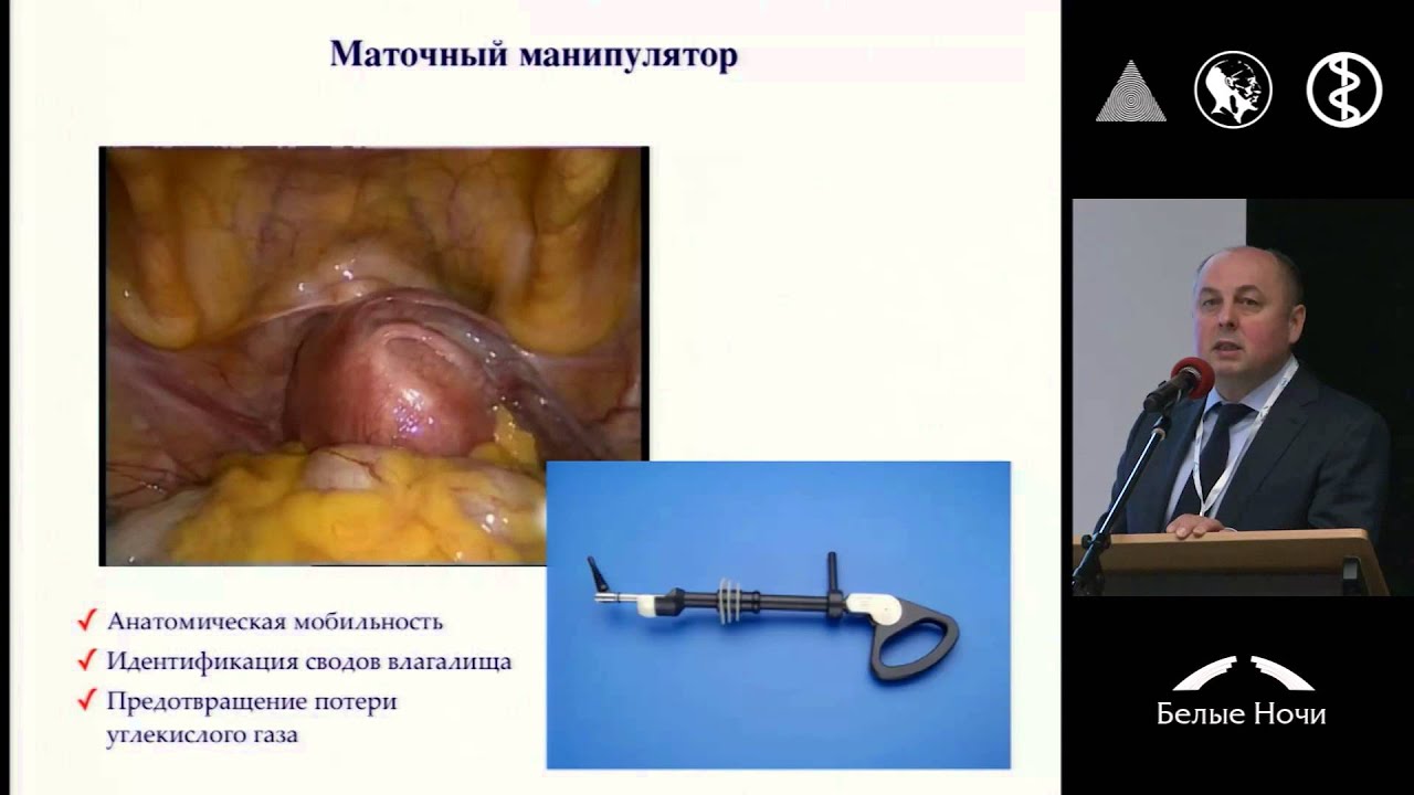Эндовидеохирургия рака шейки матки