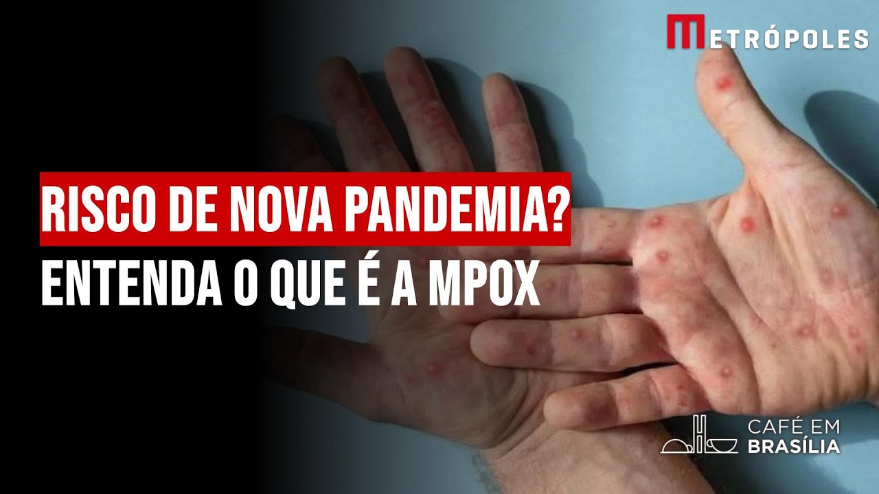 Risco de nova pandemia? Entenda o que é a Mpox - YouTube