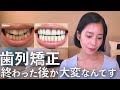 歯列矯正が終わったその後〜苦労してること3選