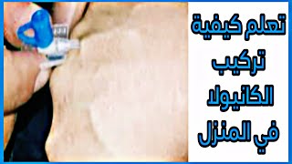 تعلم طريقة تركيب كانيولا في الوريد خطوة بخطوة (عملي) - IV Cannulation