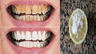 الوصفة المعجزة في تبييض الأسنان في أقل من 5 دقائق
