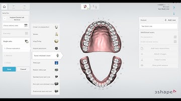 Fully Digital All-on-X Dental Implant Workflow/ H-Cap  Multiunit EZ Scanbody / Exocad design