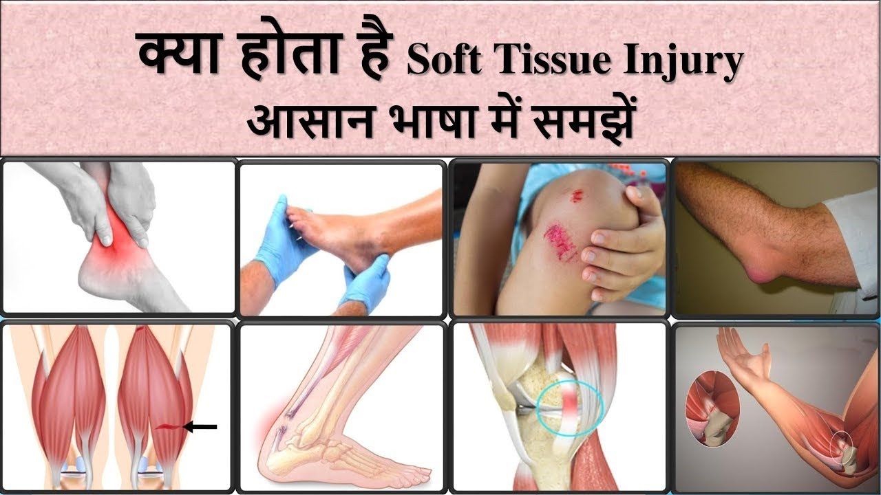 Soft Tissue Injury मांसपेशियों में खिंचाव मोच भीतरी चोट आसान भाषा में समझें Youtube