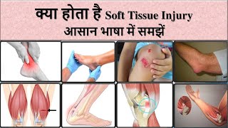 Soft Tissue Injury | मांसपेशियों में खिंचाव | मोच | भीतरी चोट | आसान भाषा में समझें screenshot 1