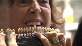 Bar à sourire : des dents de star, mais à quel prix ?