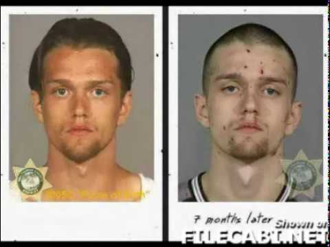 Why does meth make you ugly Why does meth make you ugly