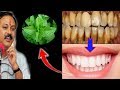 Magical Teeth whitening home remedy, get whitening teeth at home in 5 minutes