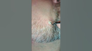 super thick beard hair! #thickhair #beard #wolfass #wire #gross #shorts