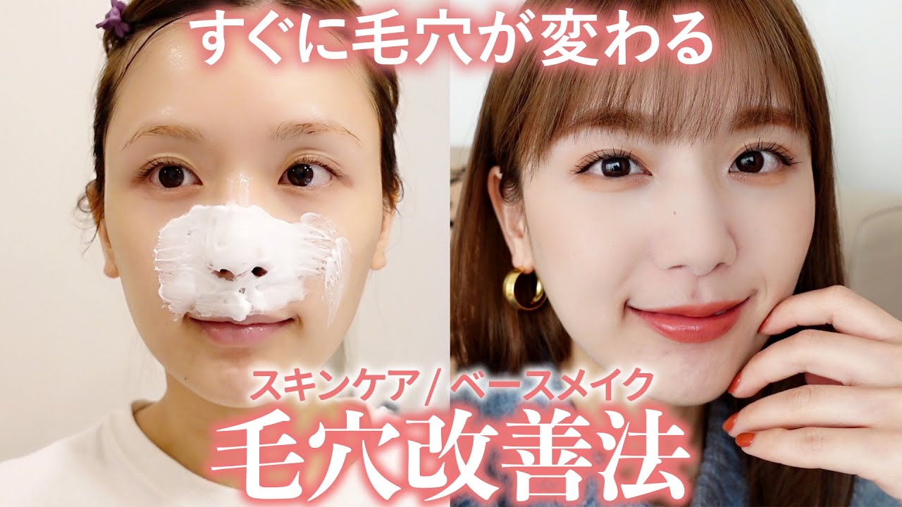 なぜ毛穴が広がってしまうのでしょうか？