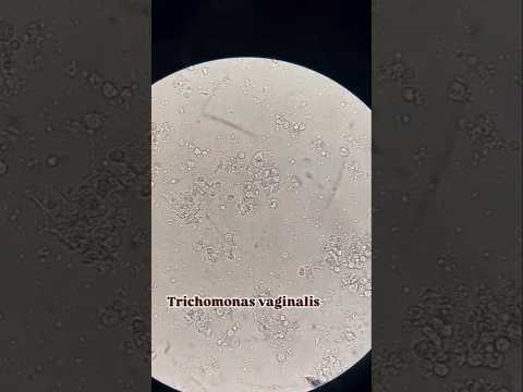 انگل تریکوموناس واژینالیس زیر میکروسکوپ 