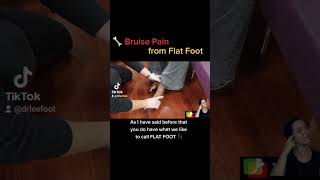 Flat 👣 Pain with Bone Bruises 👀⚡️👀 - Manhattan Foot Specialist - Dr Lee Foot