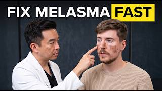 5 Moisturizers PROVEN To Reduce Melasma (Doctor Ranks)