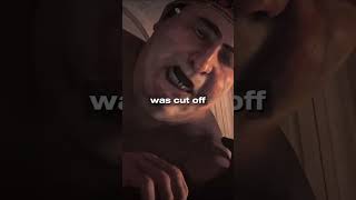 You Wont Believe Why Ins Lost A Finger