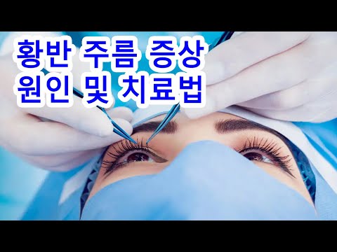 <strong>황반</strong> 주름 증상, 원인 및 치료법