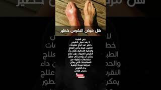 هل مرض النقرس خطير ؟ اعرف الحقيقة