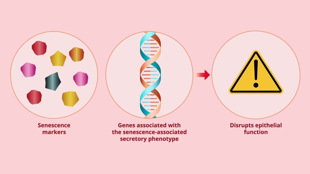 Understanding Role of Cellular Senescence in Chronic Obstructive Pulmonary Disease