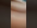 parte 2