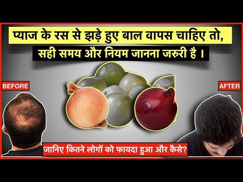 how-to-use-onion-juice-for-hair-growth?-प्याज-का-रस-कब-और-कैसे-लगाना-है?