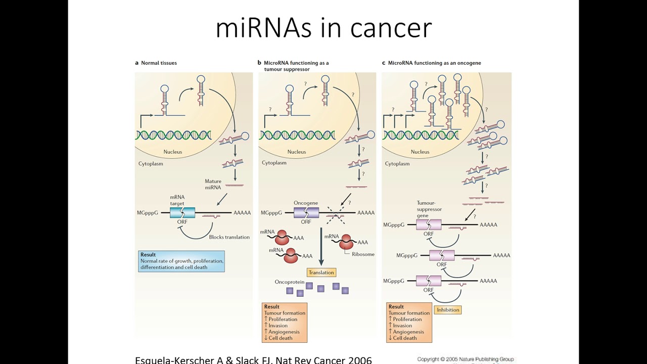 Investigating the role of microRNAs in pancreatic cancer progression ...