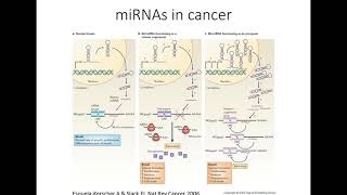 Investigating the role of microRNAs in pancreatic cancer progression