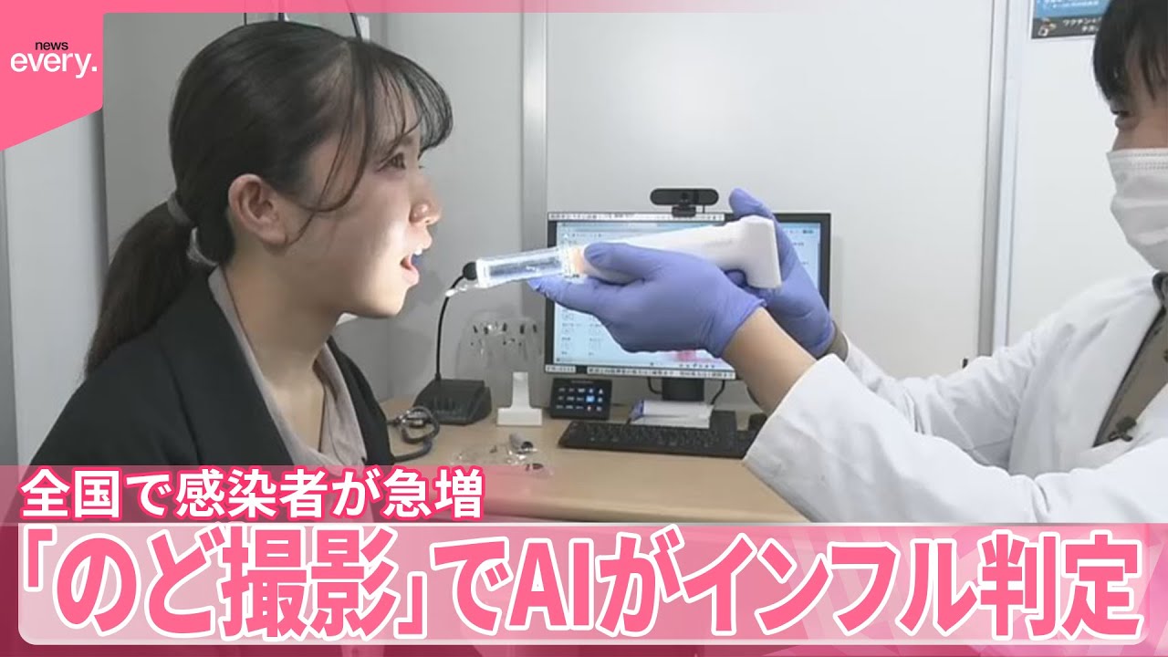 【インフル猛威】痛み少ないAI検査「のど撮影」 鼻の奥に綿棒…じゃない検査とは