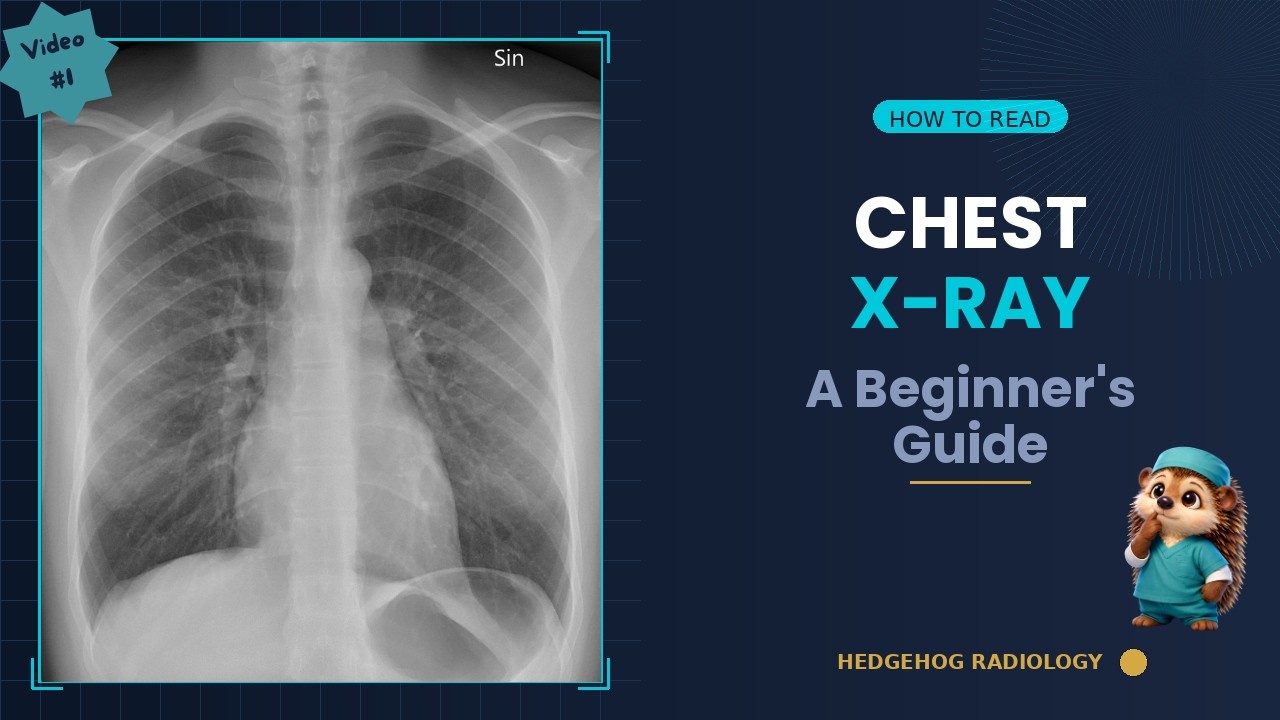 How to Read a Chest X-Ray — A Beginner's Guide - YouTube