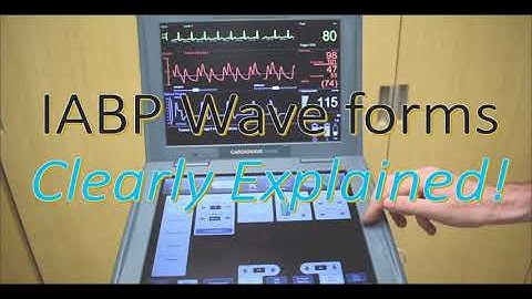 IABP Waveforms